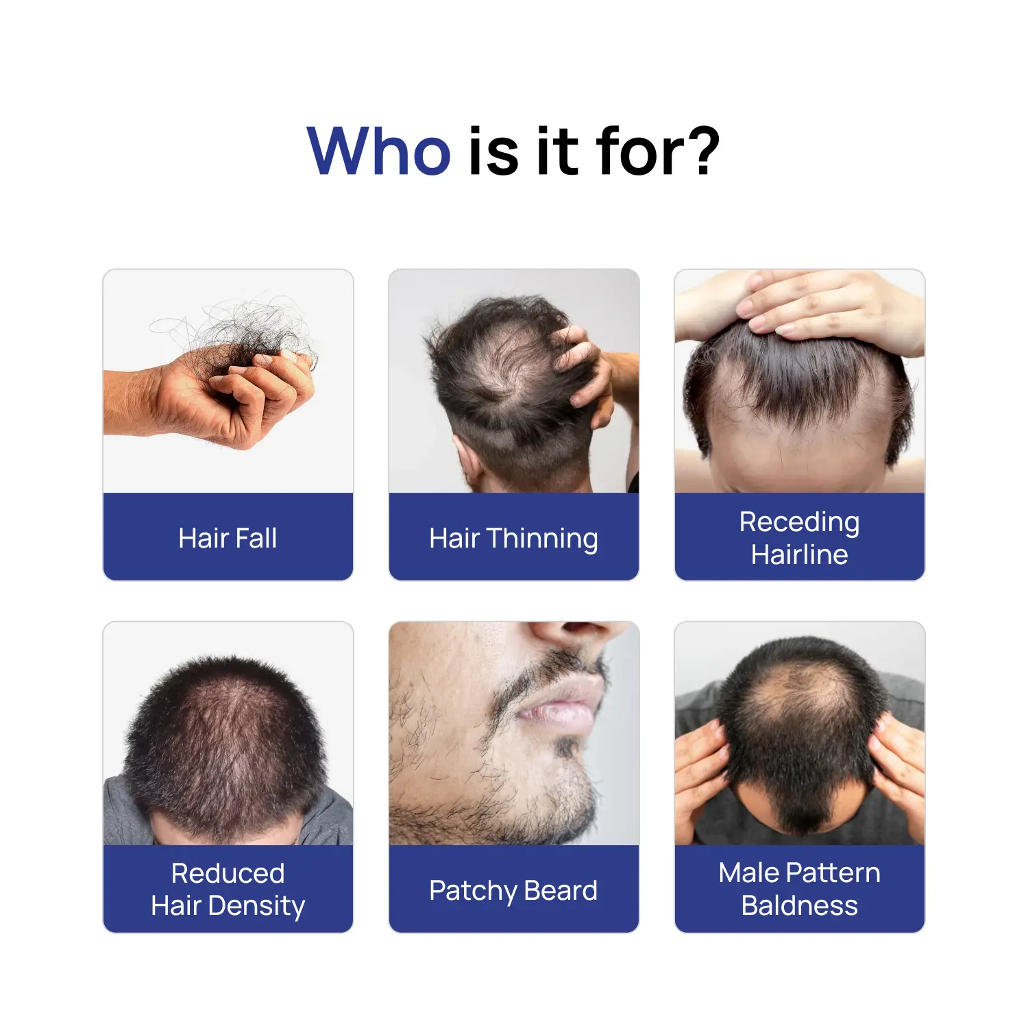 Minoxidil topical solution USP 5% - Image 11